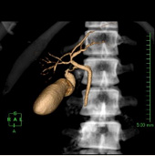 DIC-CT VR