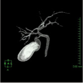 放射線科_5_CTの主な検査腹部_05