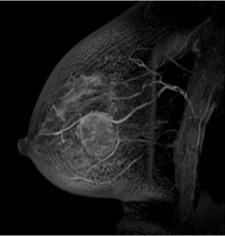 放射線科_9_MRIの主な検査　胸部_13